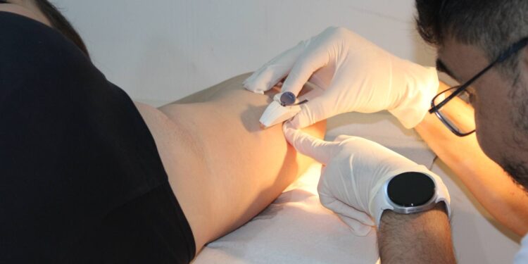 Unidades de Saúde do município passam a oferecer gratuitamente o novo método contraceptivo Implanon